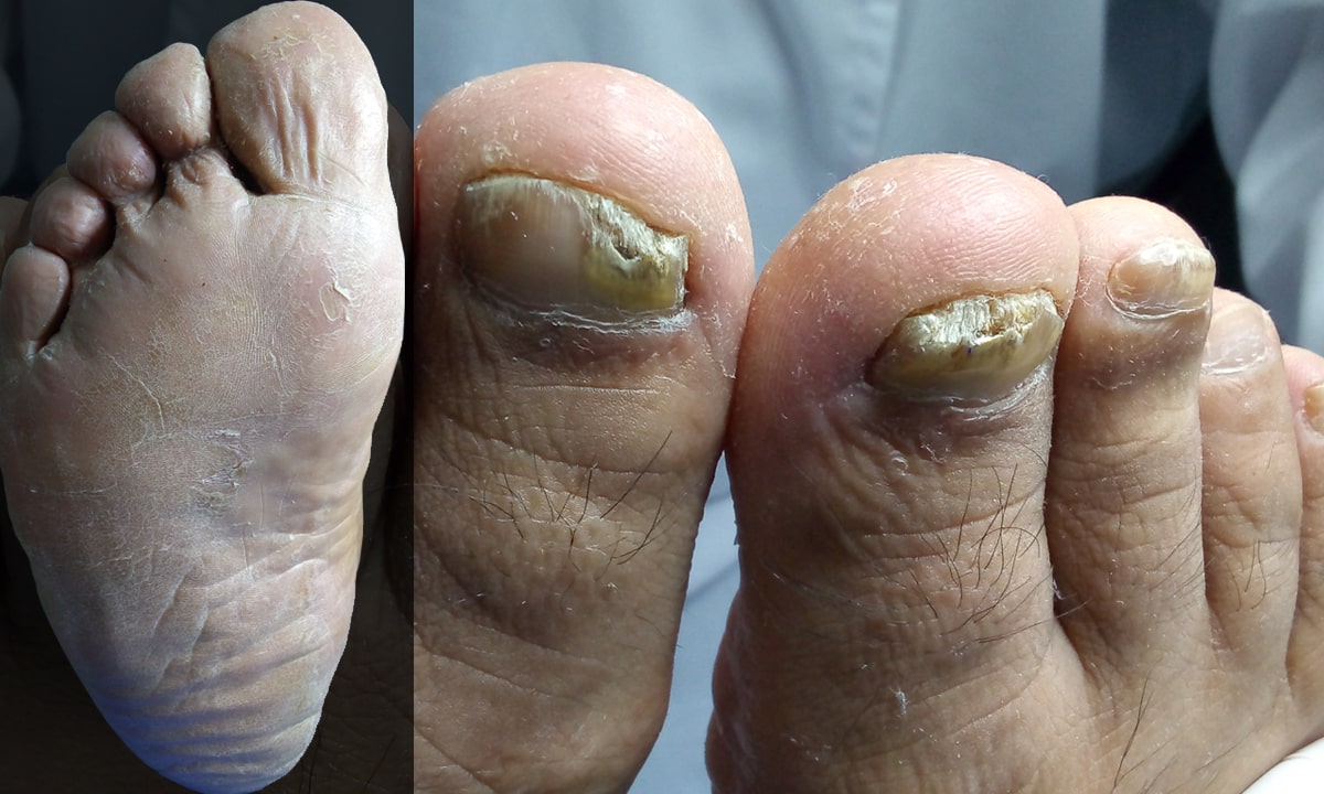 Uñas y Piel