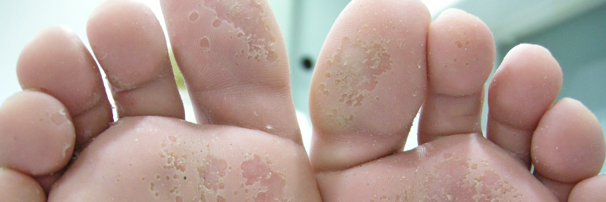 Healthy Feet