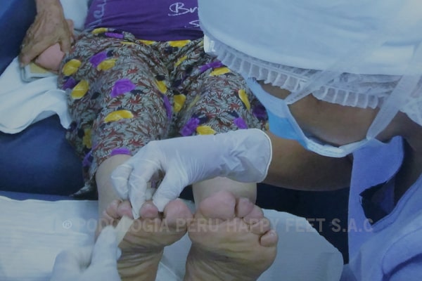 podologia en san juan de miraflores, cerca al hospital maria auxialiadora