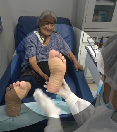 adulto mayor profilaxis(callos, uñeros, verrugas) - podologia peru