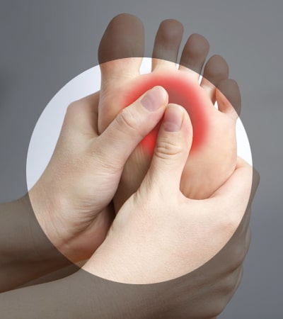 pie diabético solucion de  uñas encarnadas, callos, curacion, prevencion - podologia peru